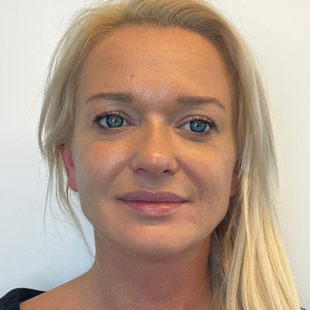 seamless-facialbalancing-before