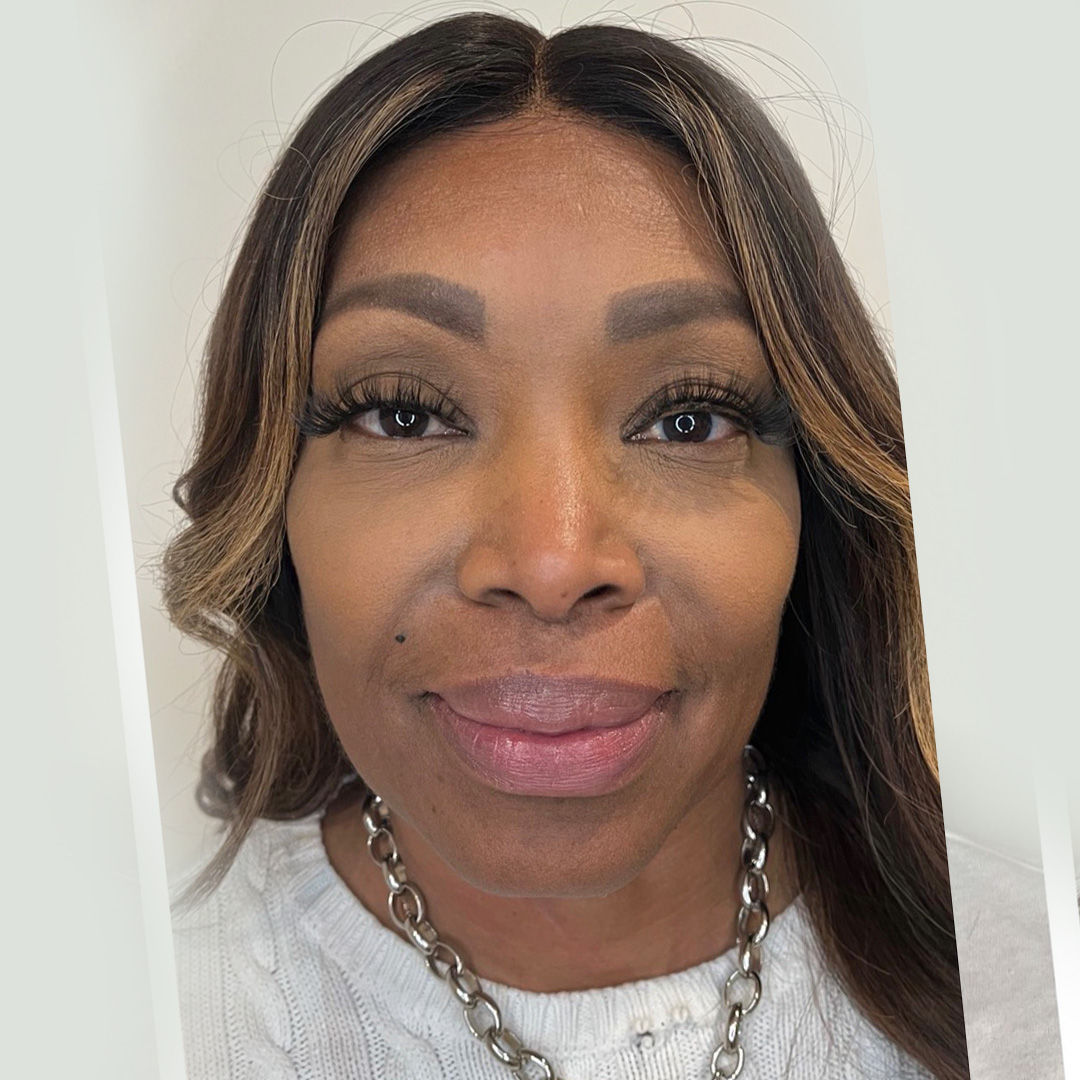 seamless-facialbalancing2-after