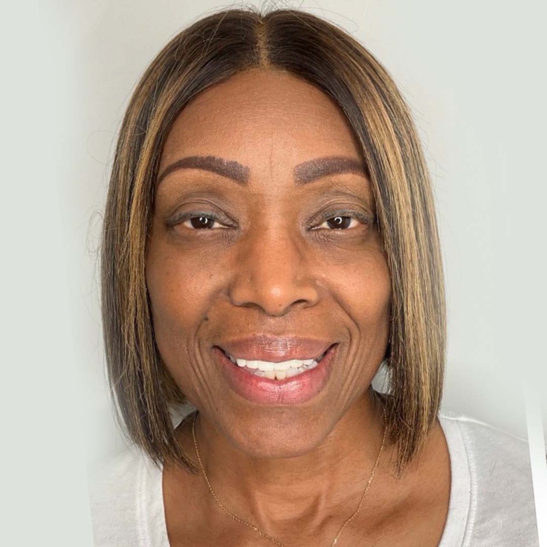 seamless-facialbalancing2-before2