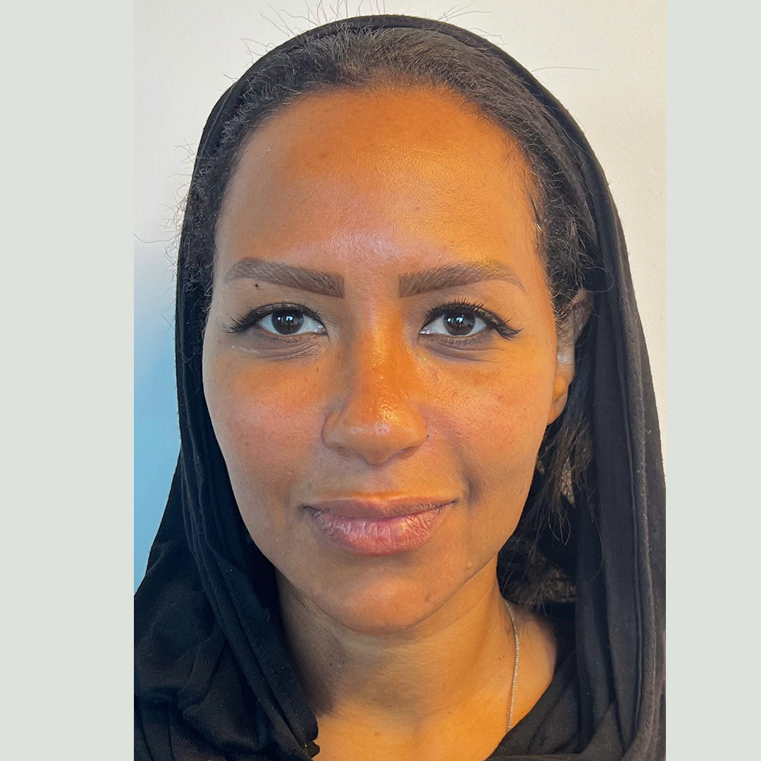 seamless-facialbalancing3-after