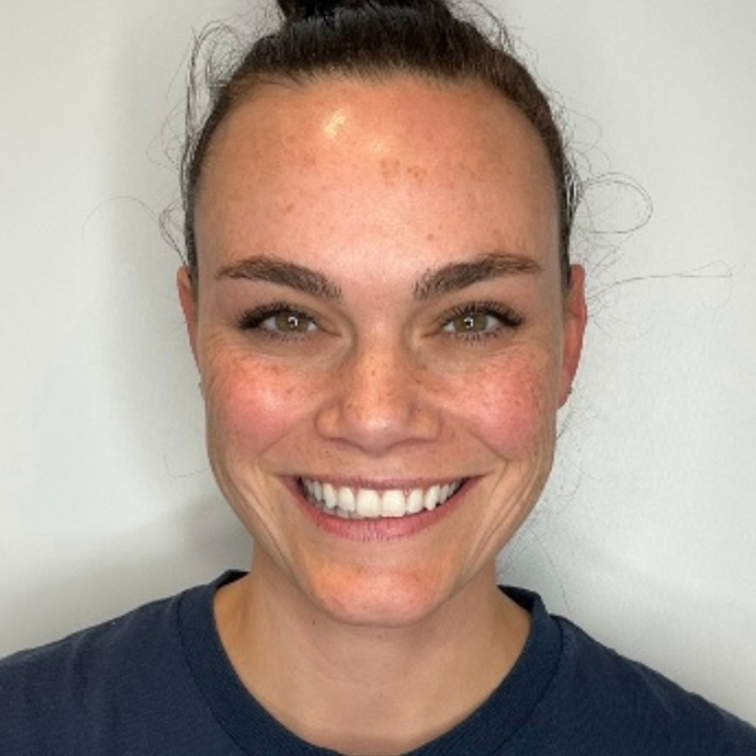 Skinvive-Brenda-After