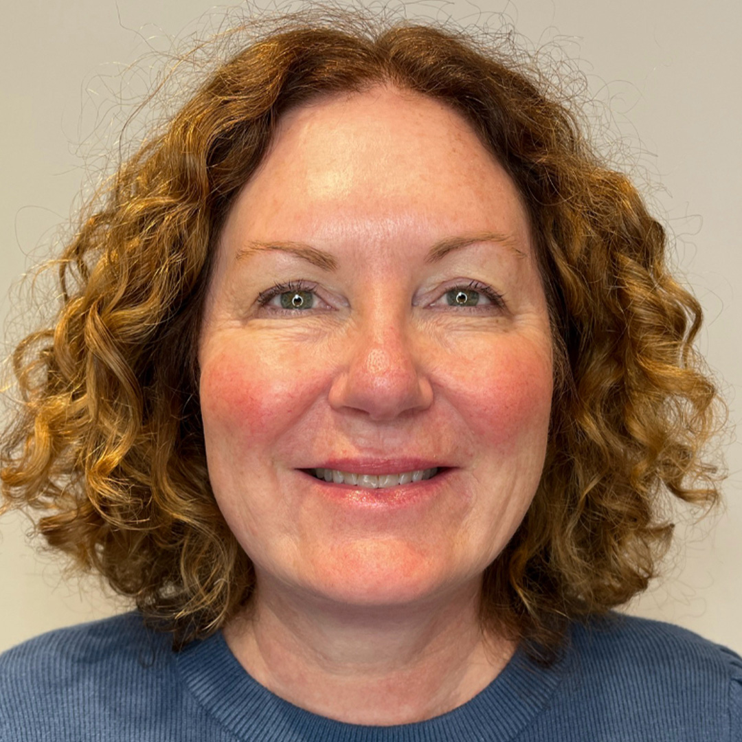 Skinvive-Janice-After