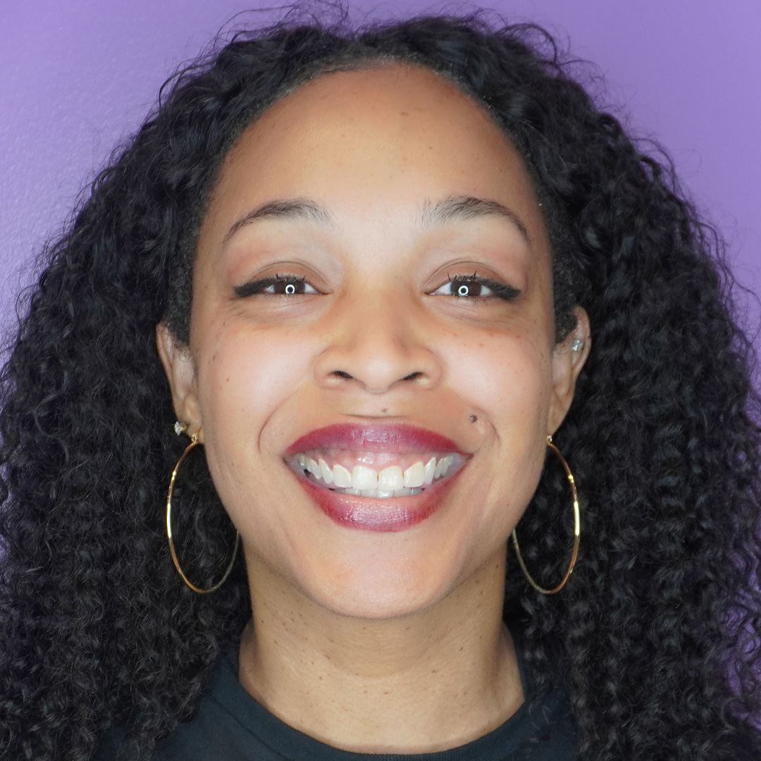 Skinvive-Mallori-After